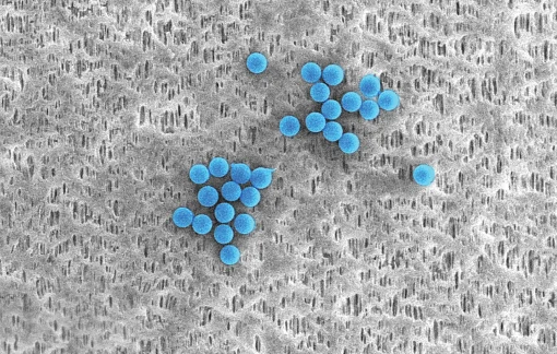 Replacement Cartridge