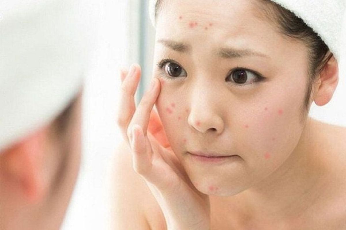 Tiếp xúc thường xuyên với nước có hàm lượng Clo cao có thể gây kích ứng da