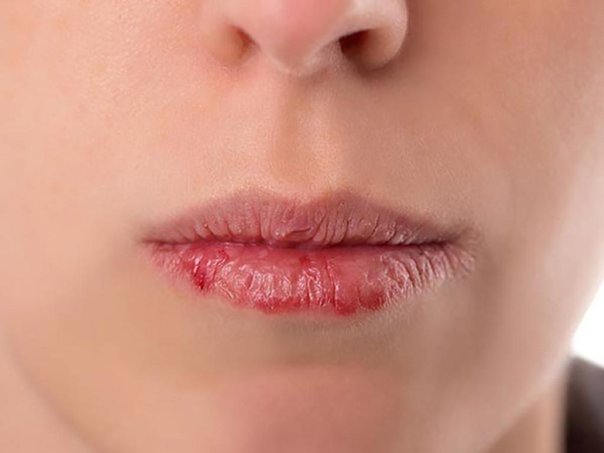 Khô môi là dấu hiệu của việc uống ít nước